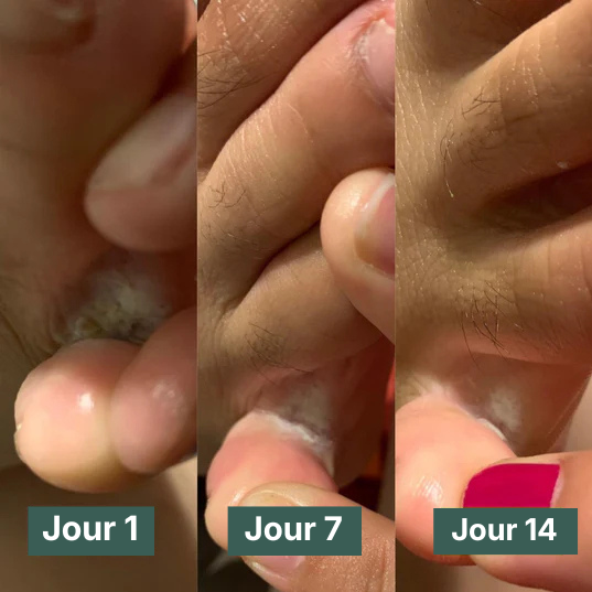 Sauvasine™ Le Savon Antifongique