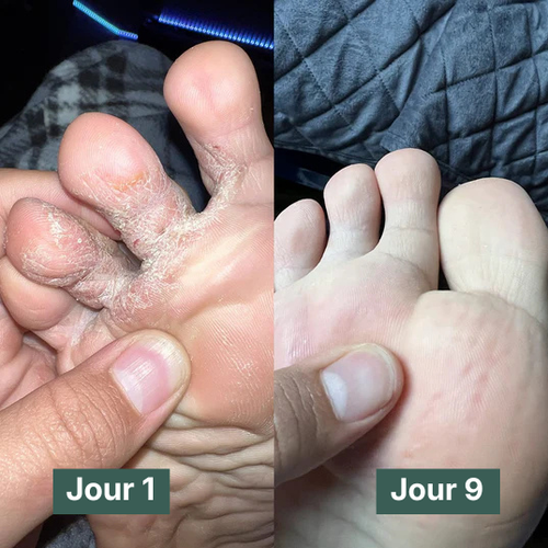 Sauvasine™ Le Savon Antifongique